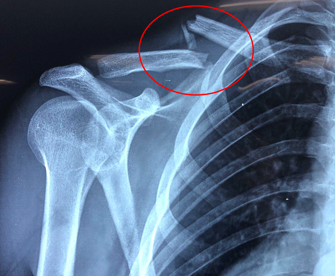 ΚΑΤΑΓΜΑ ΚΛΕΙΔΑΣ