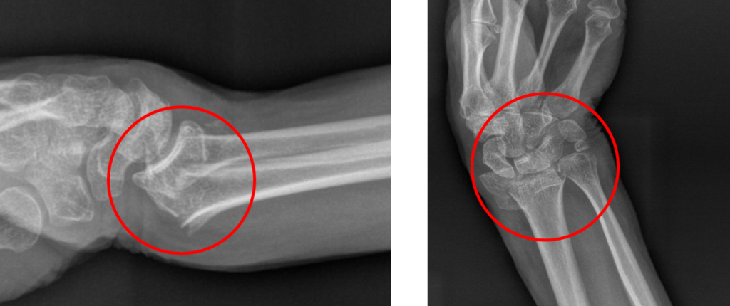 ΚΑΤΑΓΜΑ ΠΗΧΕΟΚΑΡΠΙΚΗΣ